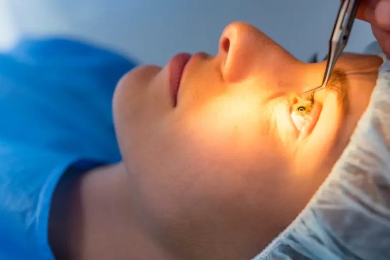 Lasik Eye Surgery Side effects and Recovery